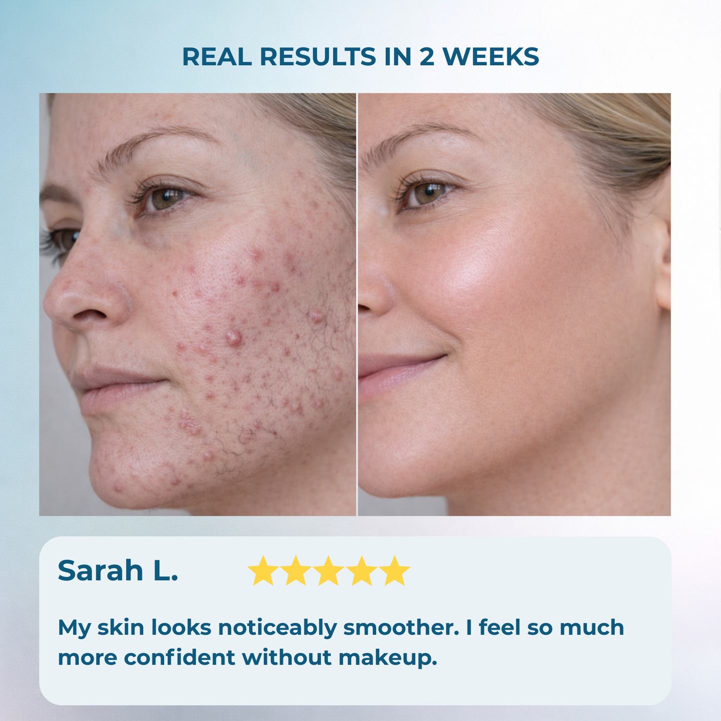 Clorns® Hormonal Hair Remover